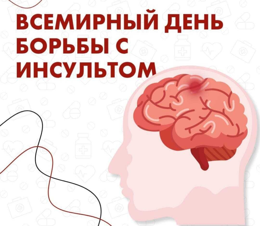 Сегодня, 29 октября, отмечается Всемирный день борьбы с инсультом.