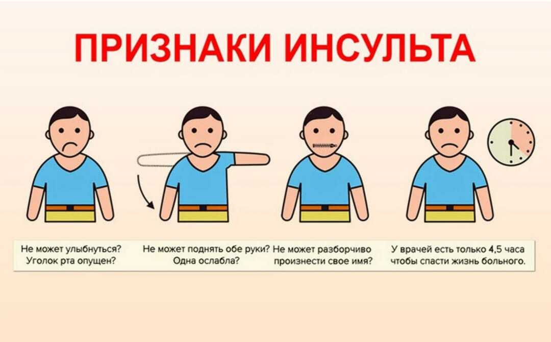 Что такое инсульт?