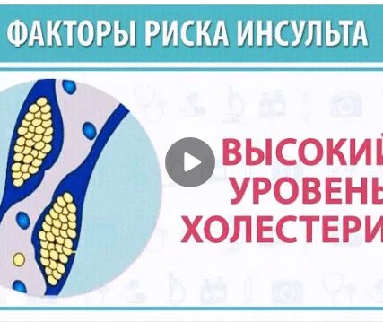 Факторы риска развития инсульта